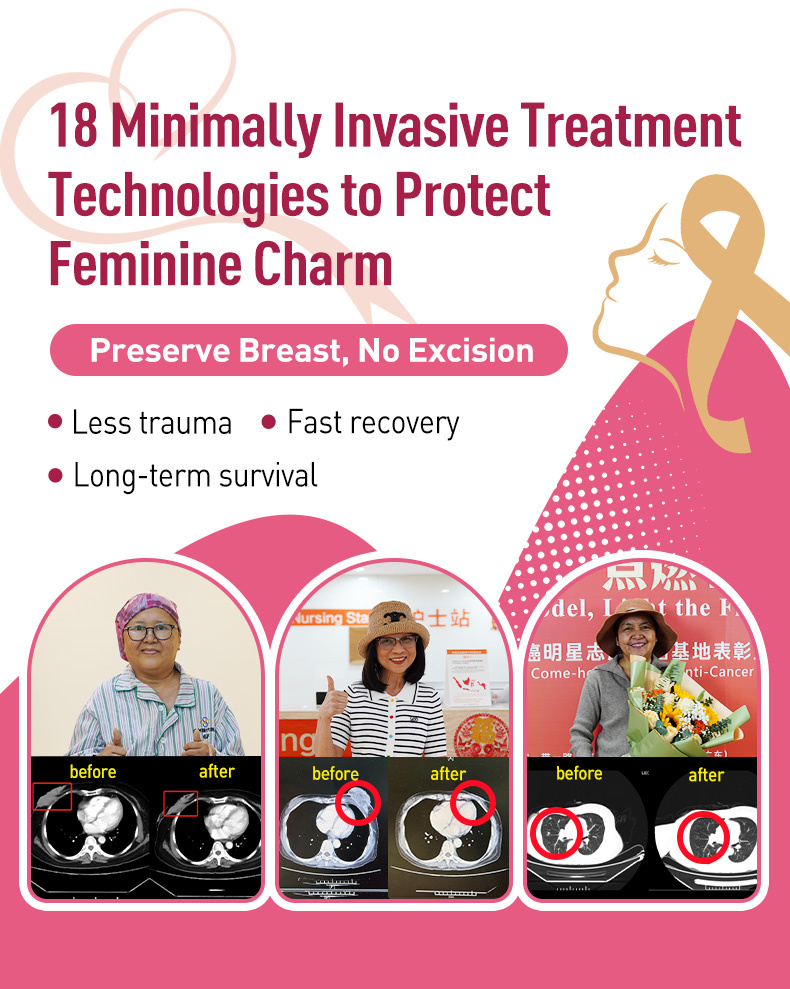 Minimally Invasive Treatments f