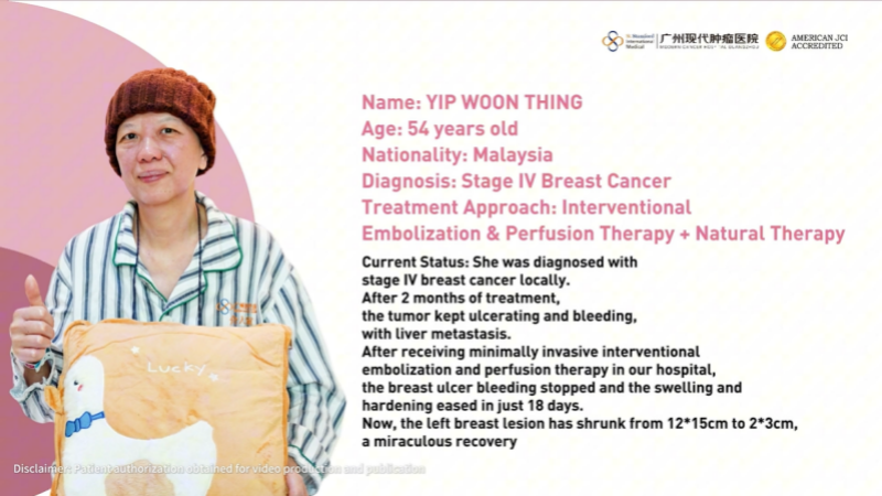Persistent Breast Tumor Ulceration and Bleeding: Hemostasis and Tumor Reduction Achieved in 18 Days with Interventional Therapy