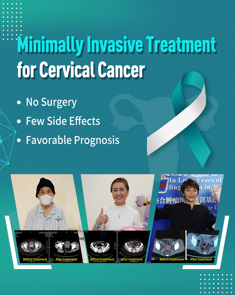 Minimally Invasive Treatments f
