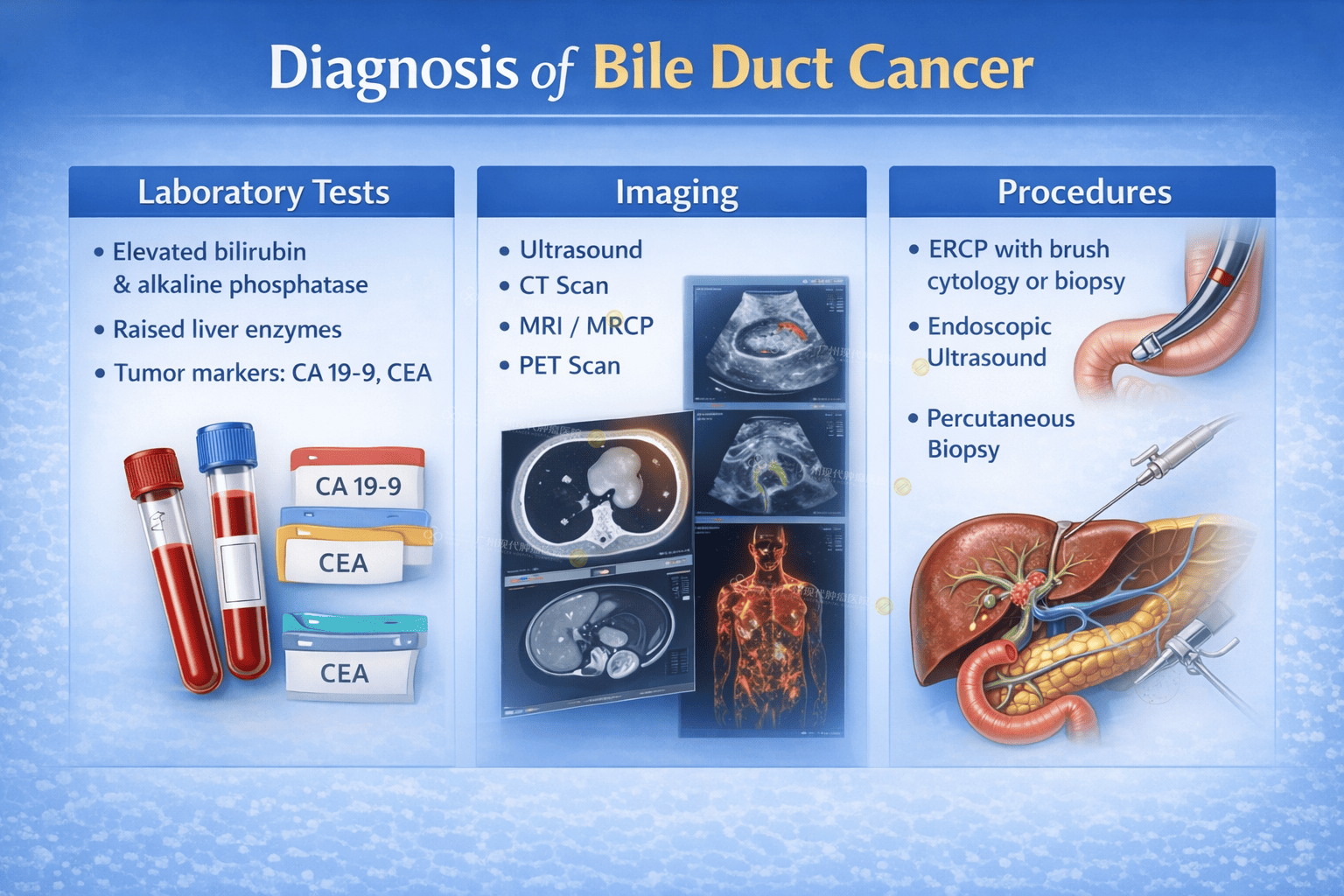 Diagnosis of Bile Duct Cancer