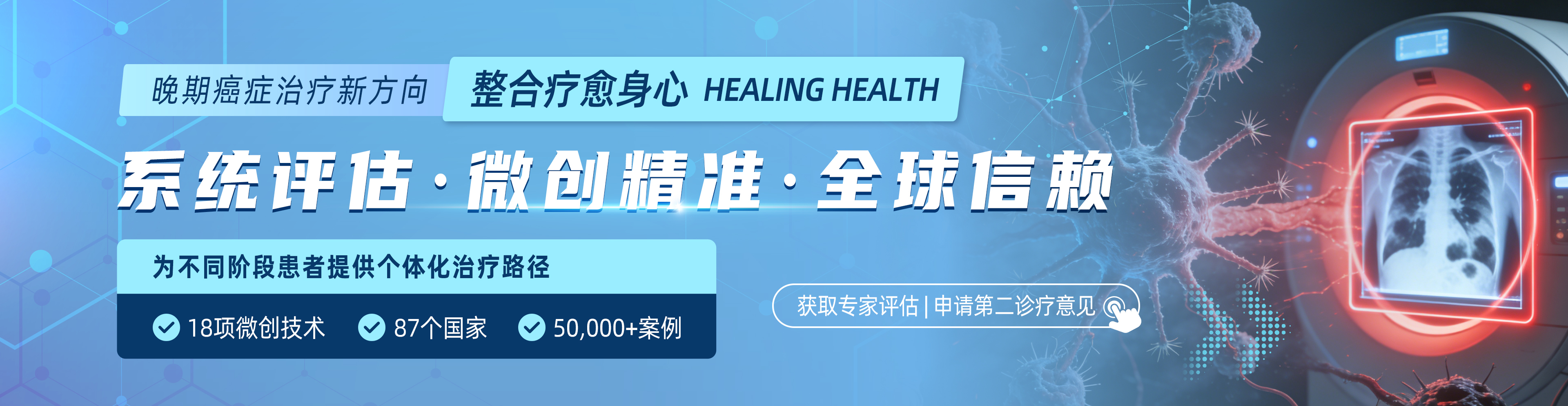 晚期癌症治疗新方向——整合疗愈身心