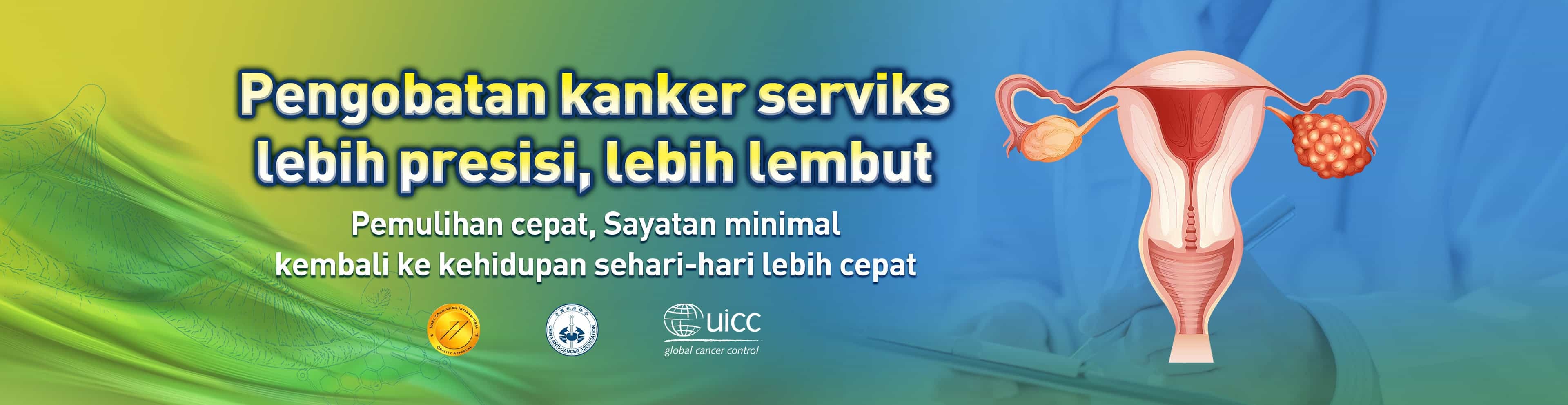 Kanker,Serviks,Pengobatan,Modern,Cancer,Hospital,Guangzhou,