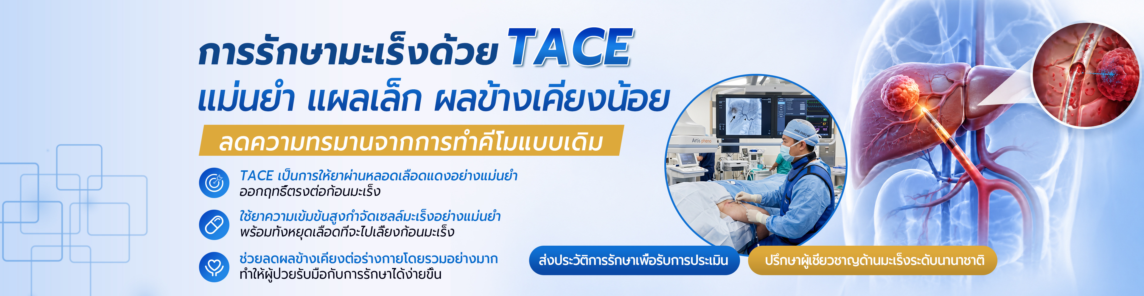 TACE治疗专题
